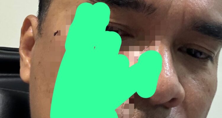 Bro ron alami pemukulan saat mendampingi karyawan PT SKS menagih hak mereka terkait dugaan penggelapan success fee di kantor MPP, kawasan Menteng, Jakarta Pusat, Foto/Istimewa