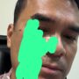 Bro ron alami pemukulan saat mendampingi karyawan PT SKS menagih hak mereka terkait dugaan penggelapan success fee di kantor MPP, kawasan Menteng, Jakarta Pusat, Foto/Istimewa